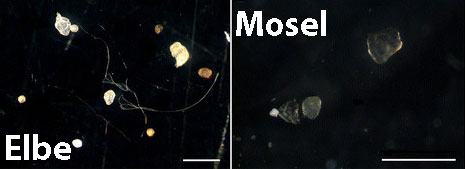Mikroplastik